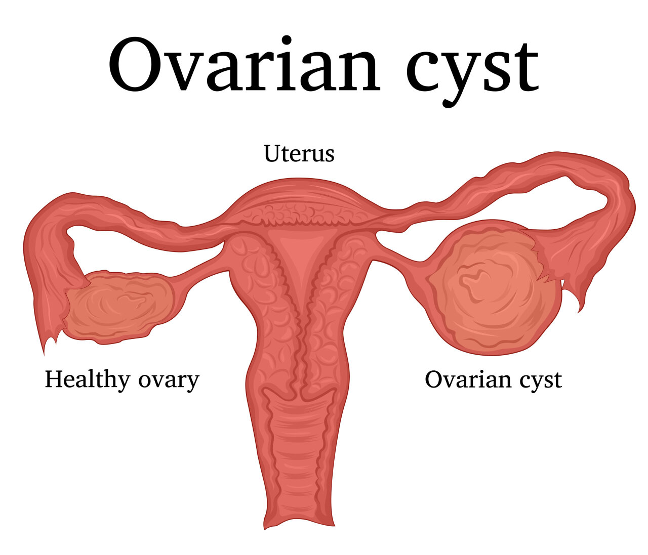 For Sale: INFERTILITY Products